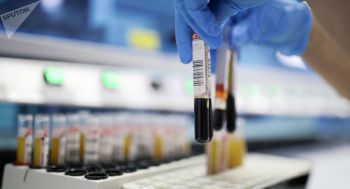 В начале будущего года в Георгиевске появится ПЦР-лаборатория, что сократит сроки получения результатов тестов на коронавирус